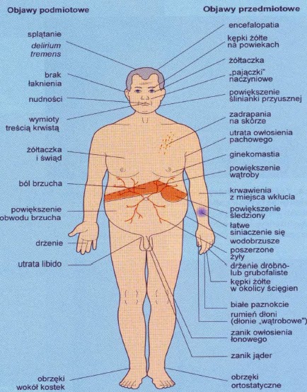 kiepska wątroba