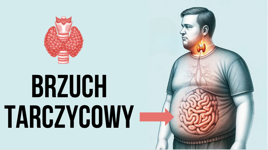 Brzuch tarczycowy: Przyczyny, objawy i strategie leczenia.